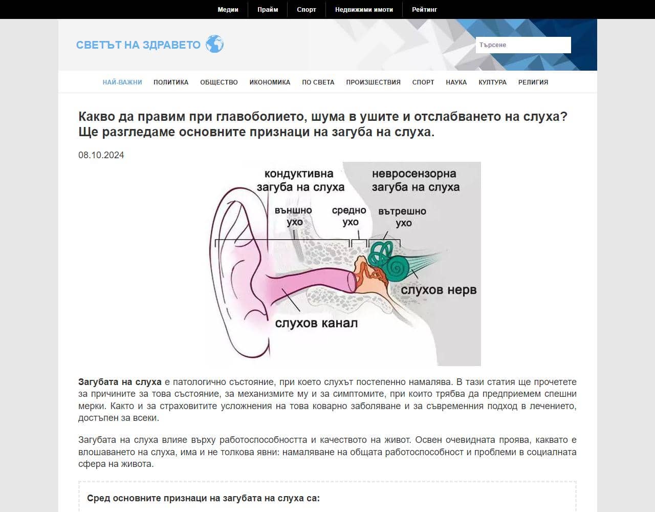 Acustal 1